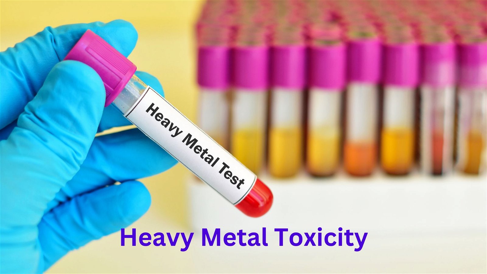 Heavy Metal Toxicity