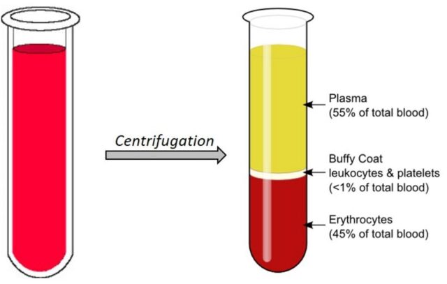 Bombay Blood Group is extremely rare (1 in 4 million) - PMF IAS