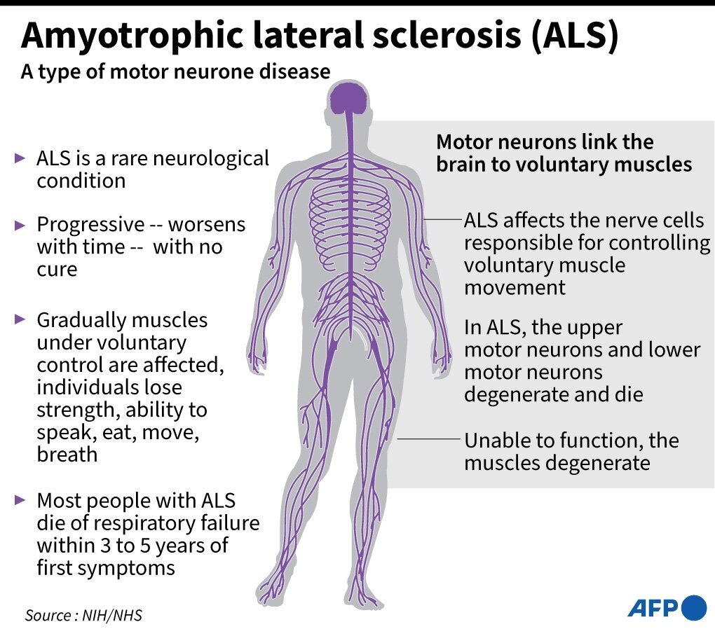 Amyotrophic Lateral Sclerosis (ALS)