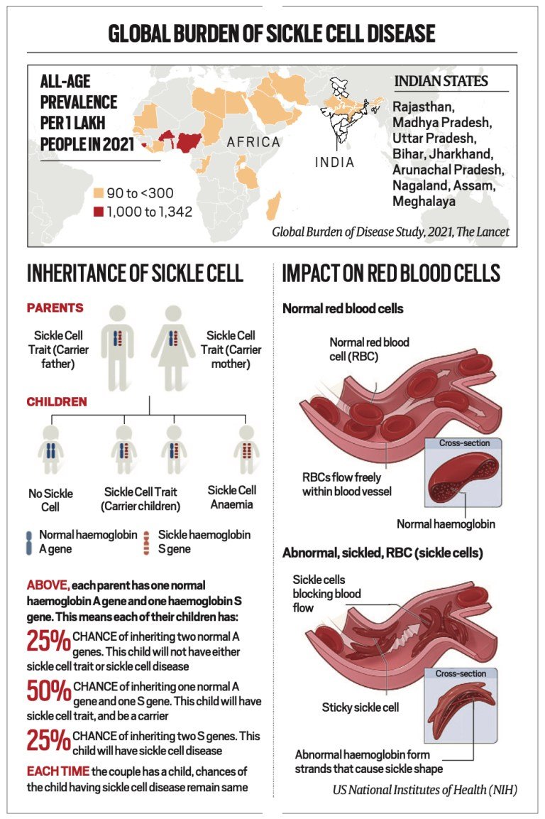 Sickle Cell. Its Outbreak, how it spreads and Cross Section of a Sickle Cell.