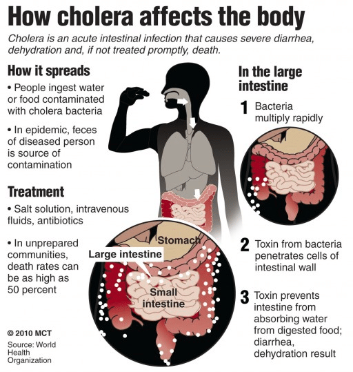 Cholera - PMF IAS