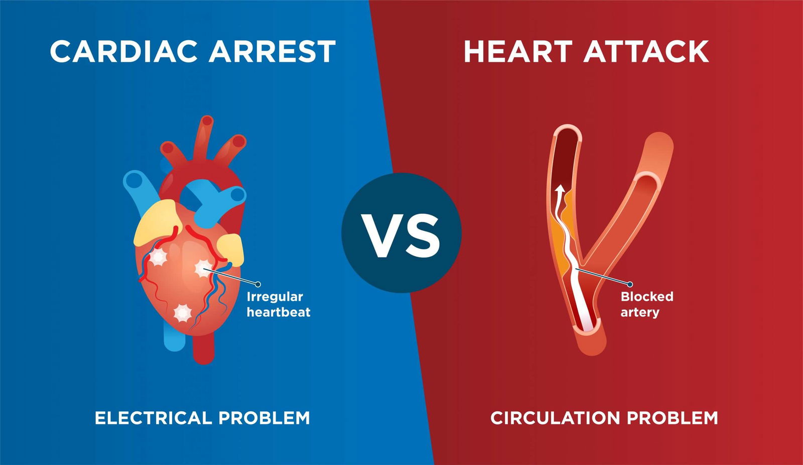 Cardiac Arrest & Heart Attack